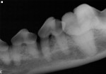 Dental X-ray Left Mandibular Dental X-ray Left Mandibular